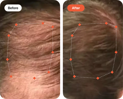 Turning Back the Clock on My Scalp